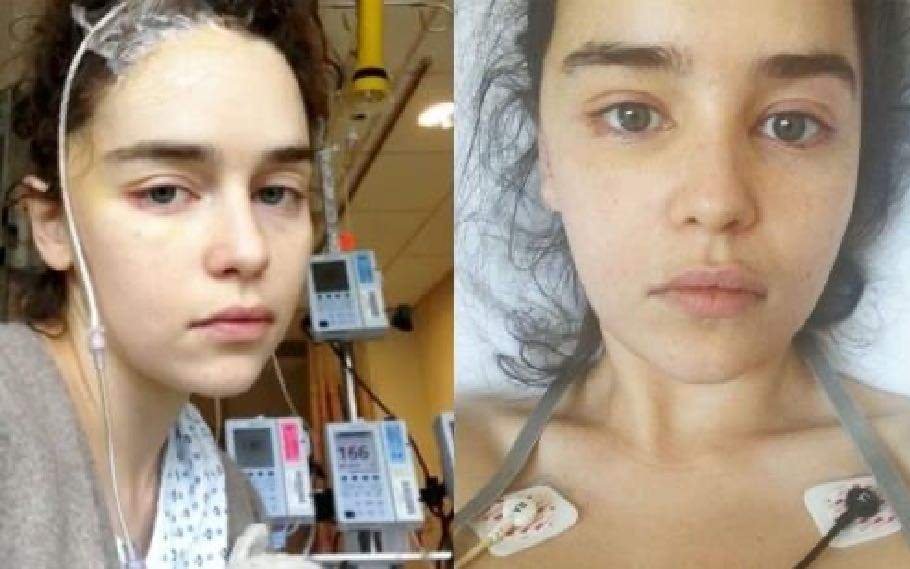 GOT actor Emilia Clarke talks about her recent brain surgery; Says she was unable to recall her name 2 Games of Thrones