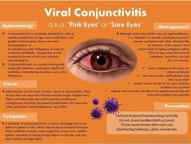 Pink eye: Surge in Contagious Conjunctivitis Cases Amidst Persistent Rains Prompts Health Concerns