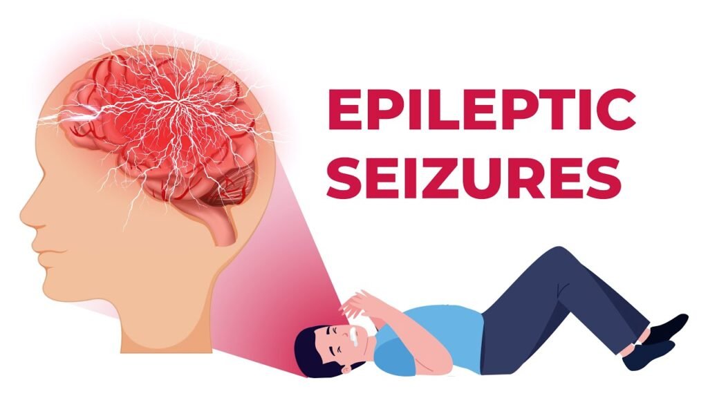 Over 70% Epilepsy Cases Can Be Controlled with Early Diagnosis, Says GNRC Hospitals 1 maxresdefault